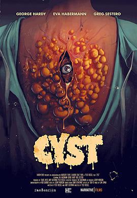囊肿 CYST.2020 字幕下载